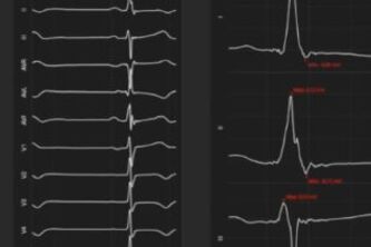 Cardio Vision