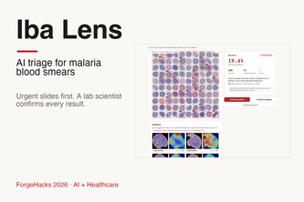 Iba Lens