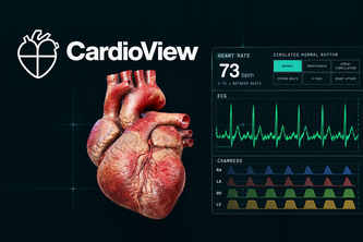 CardioView