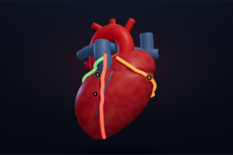 CardioVista