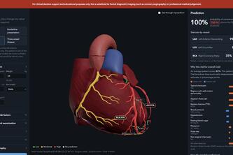 CardioLens