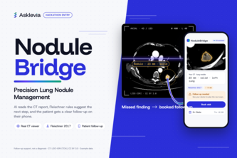 NoduleBridge By Asklevia
