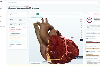 CardioVista: 3D AI Coronary Artery Disease Detection