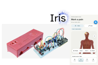 Iris