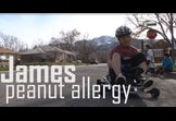 James and the Peanut Allergy