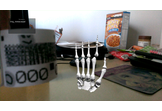 Medical Augmented Reality