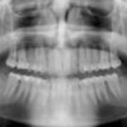 George Hofheimer