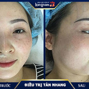 Trị tàn nhang Kangnam's avatar