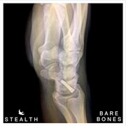 {DOWNLOAD} Stealth -  Bare Bones - EP {ALBUM MP3 ZIP}'s avatar