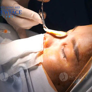 Nâng Mũi Phẫu Thuật's avatar