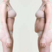 Liposuction   Riyadh's avatar